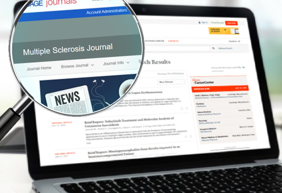 Artículos Científicos 7 multiple sclerosis journal
